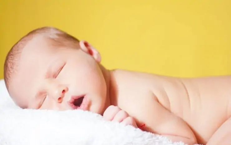 Sarılık Nedir? Bebeklerde Sarılık