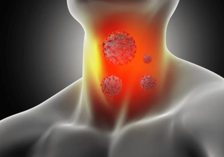 Gırtlak Kanseri İçin Hangi Oranda Engelli Raporu Verilir?