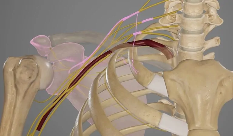 Brakial Pleksus İçin Hangi Oranda Engelli Raporu Verilir?