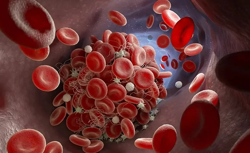 Faktör V Leiden Mutasyonu İçin Hangi Oranda Engelli Raporu Verilir?