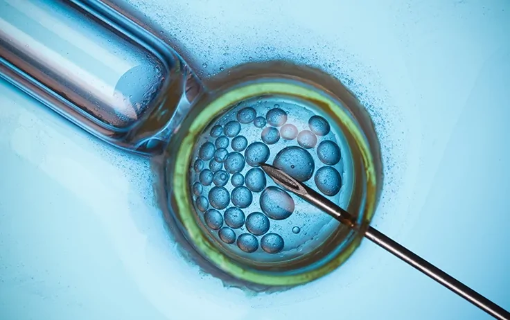 N46: Erkek İnfertilitesi İçin Hangi Oranda Engelli Raporu Verilir?